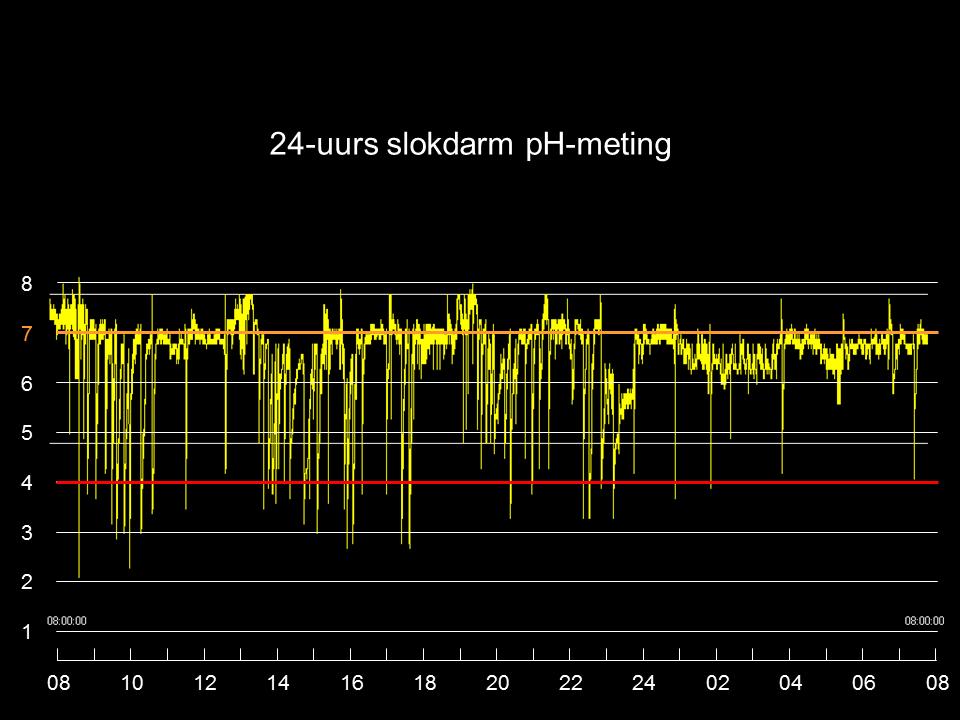 24uurs slokdarm pH meting